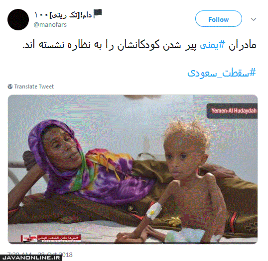 کودکان یمنی پیر می‌شوند